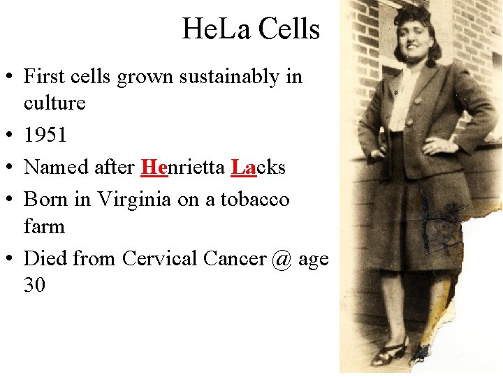 He. La Cells • First cells grown sustainably in culture • 1951 • Named