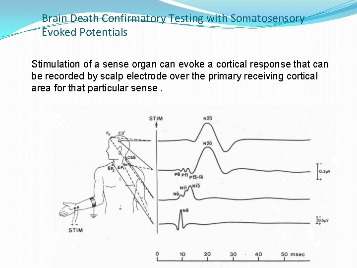 Brain Death Confirmatory Testing with Somatosensory Evoked Potentials Stimulation of a sense organ can