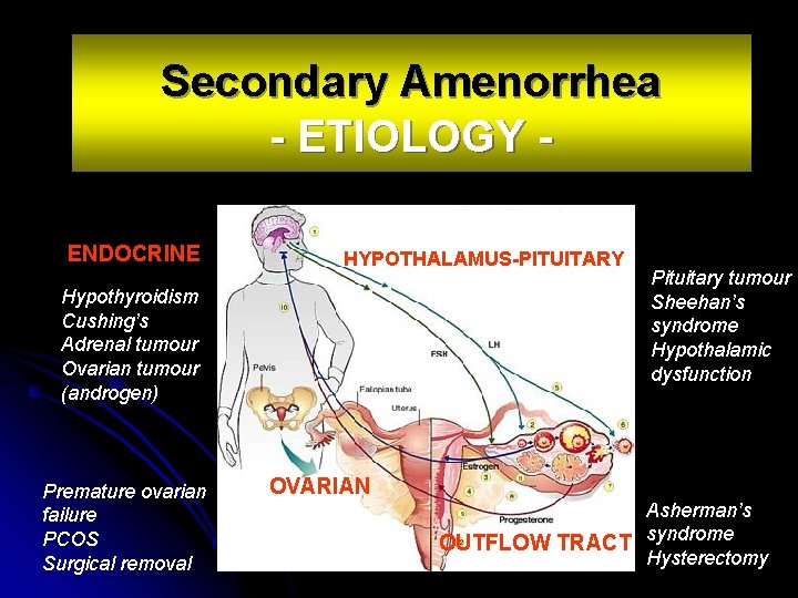 Secondary Amenorrhea - ETIOLOGY ENDOCRINE HYPOTHALAMUS-PITUITARY Hypothyroidism Cushing’s Adrenal tumour Ovarian tumour (androgen) Premature