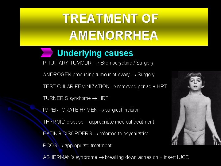 TREATMENT OF AMENORRHEA Underlying causes PITUITARY TUMOUR Bromocryptine / Surgery ANDROGEN producing tumour of