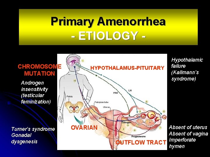 Primary Amenorrhea - ETIOLOGY CHROMOSOME MUTATION HYPOTHALAMUS-PITUITARY Androgen insensitivity (testicular feminization) Turner’s syndrome Gonadal