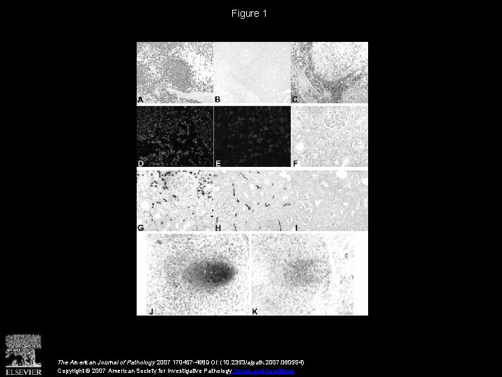 Figure 1 The American Journal of Pathology 2007 170457 -468 DOI: (10. 2353/ajpath. 2007.