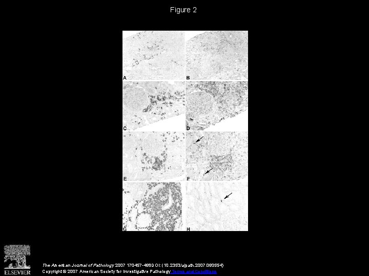 Figure 2 The American Journal of Pathology 2007 170457 -468 DOI: (10. 2353/ajpath. 2007.