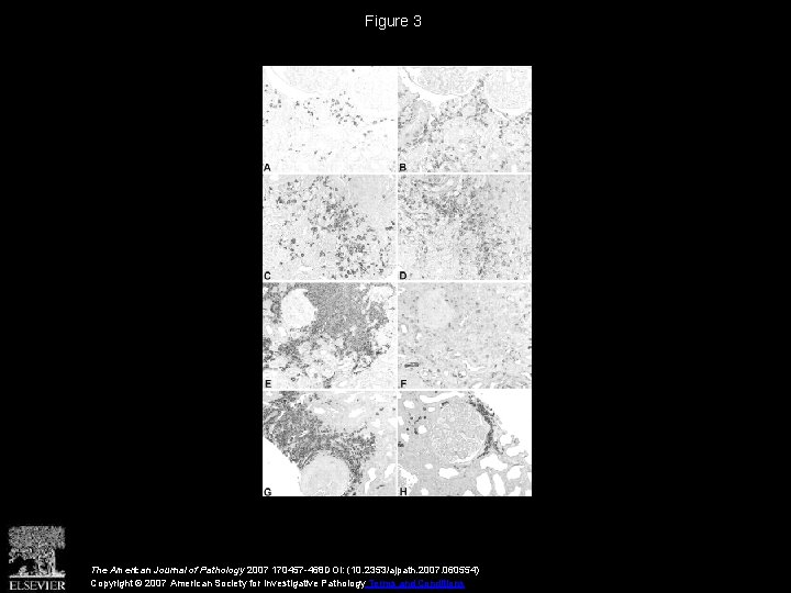 Figure 3 The American Journal of Pathology 2007 170457 -468 DOI: (10. 2353/ajpath. 2007.