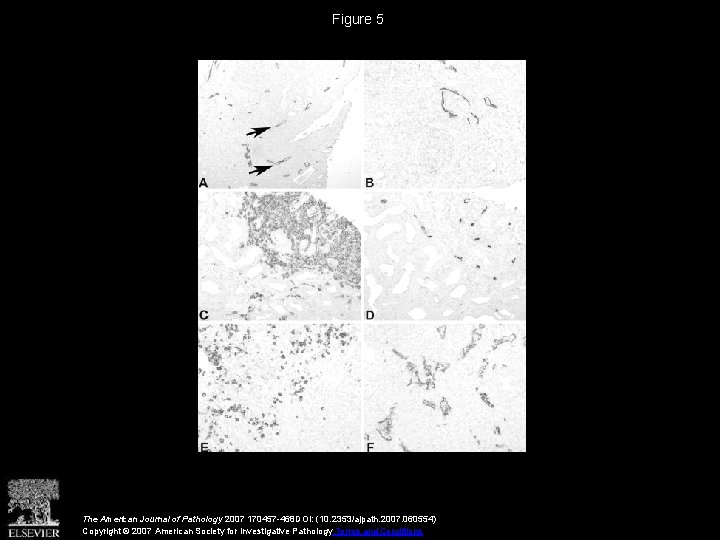 Figure 5 The American Journal of Pathology 2007 170457 -468 DOI: (10. 2353/ajpath. 2007.