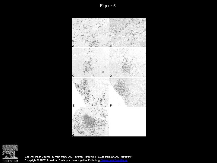 Figure 6 The American Journal of Pathology 2007 170457 -468 DOI: (10. 2353/ajpath. 2007.
