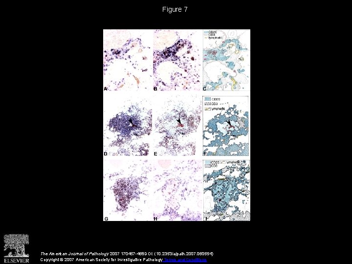 Figure 7 The American Journal of Pathology 2007 170457 -468 DOI: (10. 2353/ajpath. 2007.