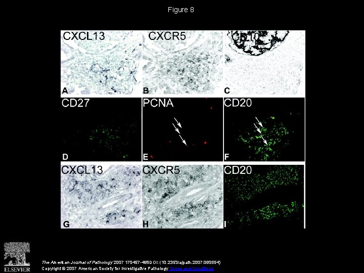 Figure 8 The American Journal of Pathology 2007 170457 -468 DOI: (10. 2353/ajpath. 2007.