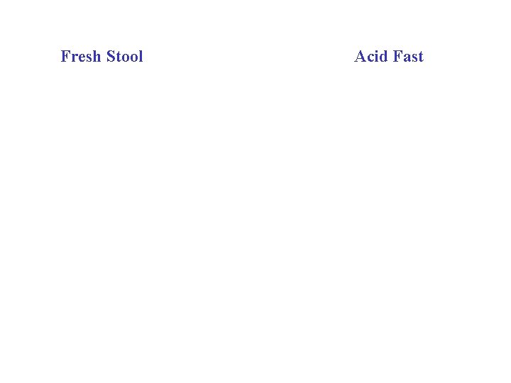 Fresh Stool Acid Fast 