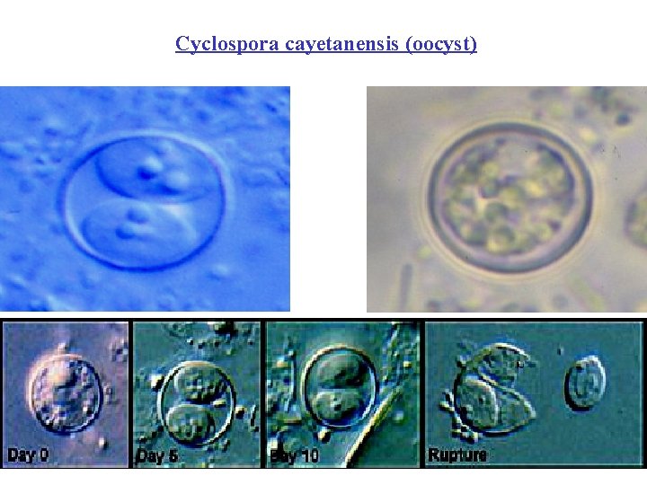 Cyclospora cayetanensis (oocyst) 