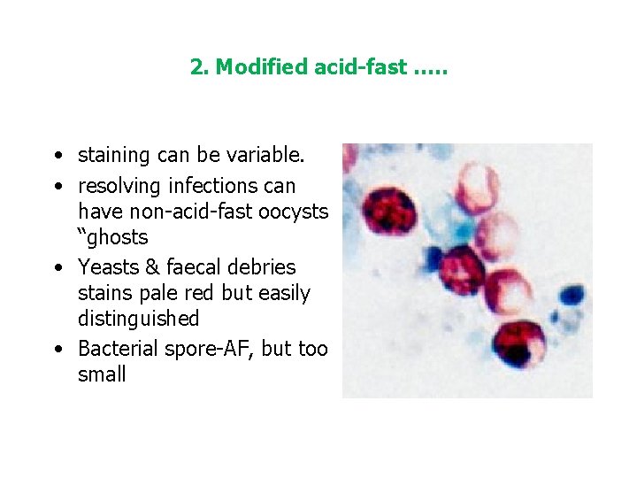 2. Modified acid-fast …. . • staining can be variable. • resolving infections can
