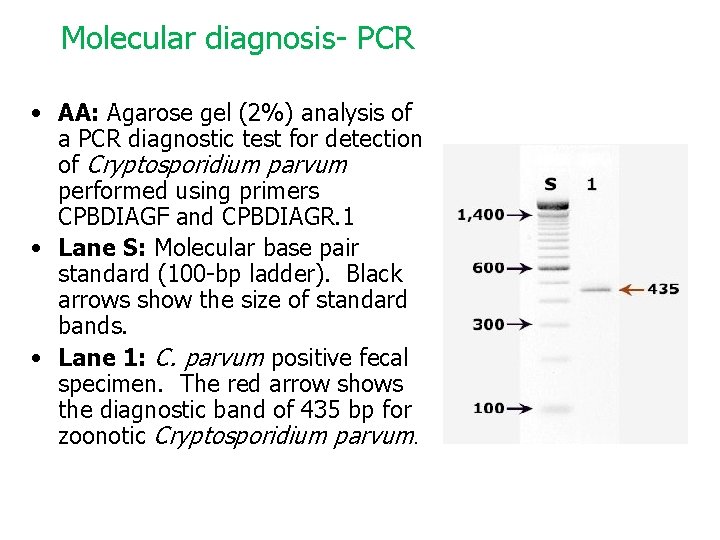 Molecular diagnosis- PCR • AA: Agarose gel (2%) analysis of a PCR diagnostic test