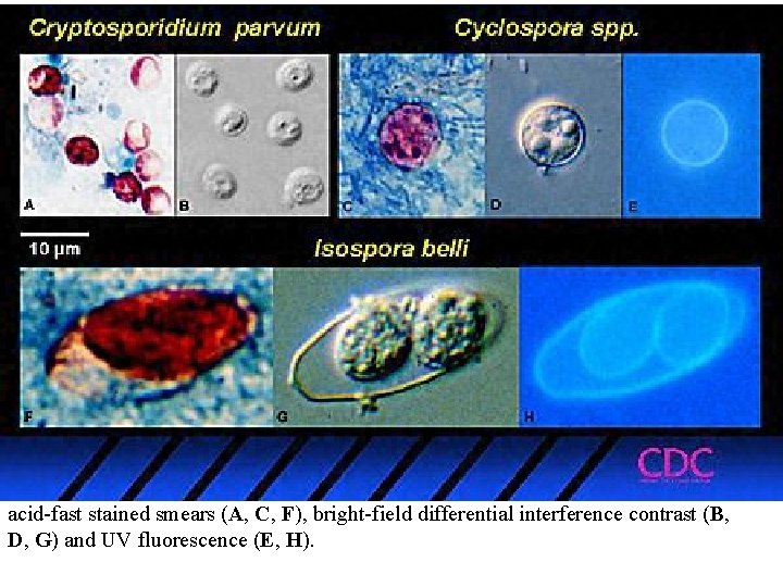 acid-fast stained smears (A, C, F), bright-field differential interference contrast (B, D, G) and