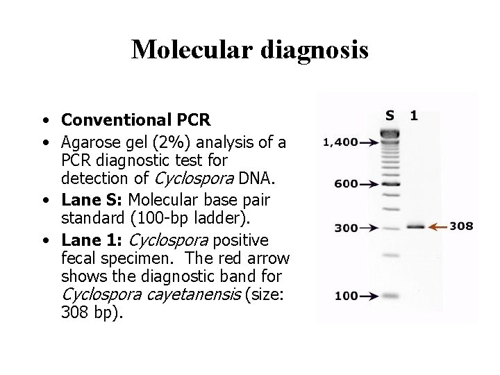 Molecular diagnosis • Conventional PCR • Agarose gel (2%) analysis of a PCR diagnostic