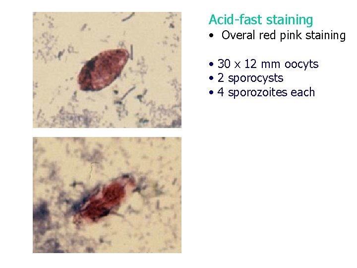 Acid-fast staining • Overal red pink staining • 30 x 12 mm oocyts •