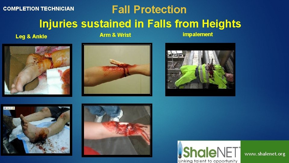 Fall Protection Injuries sustained in Falls from Heights COMPLETION TECHNICIAN Leg & Ankle Arm