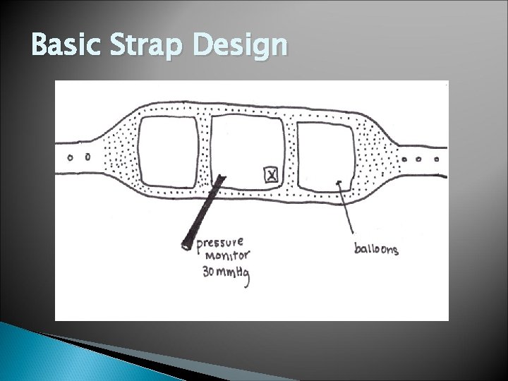 Basic Strap Design 