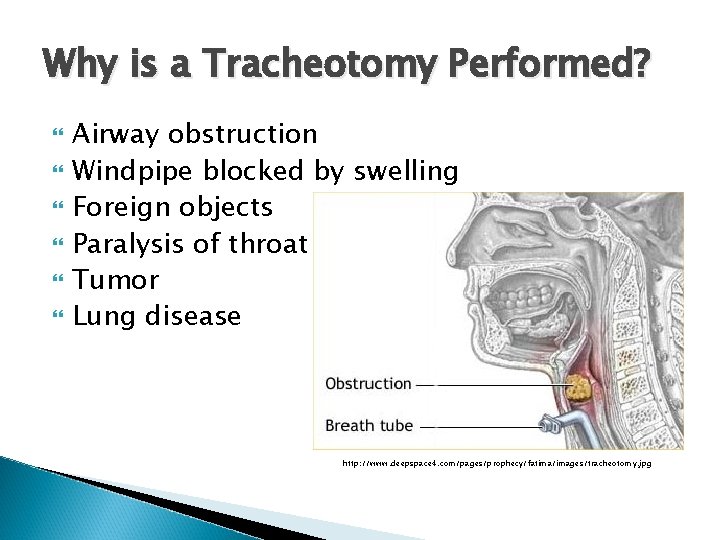 Why is a Tracheotomy Performed? Airway obstruction Windpipe blocked by swelling Foreign objects Paralysis