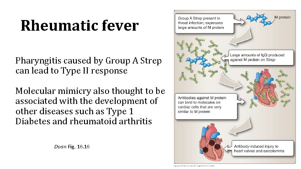 Rheumatic fever Pharyngitis caused by Group A Strep can lead to Type II response
