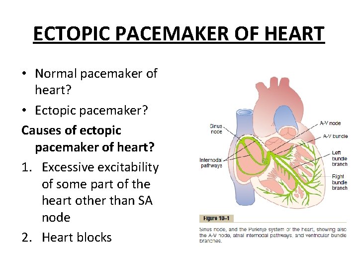 ECTOPIC PACEMAKER OF HEART • Normal pacemaker of heart? • Ectopic pacemaker? Causes of
