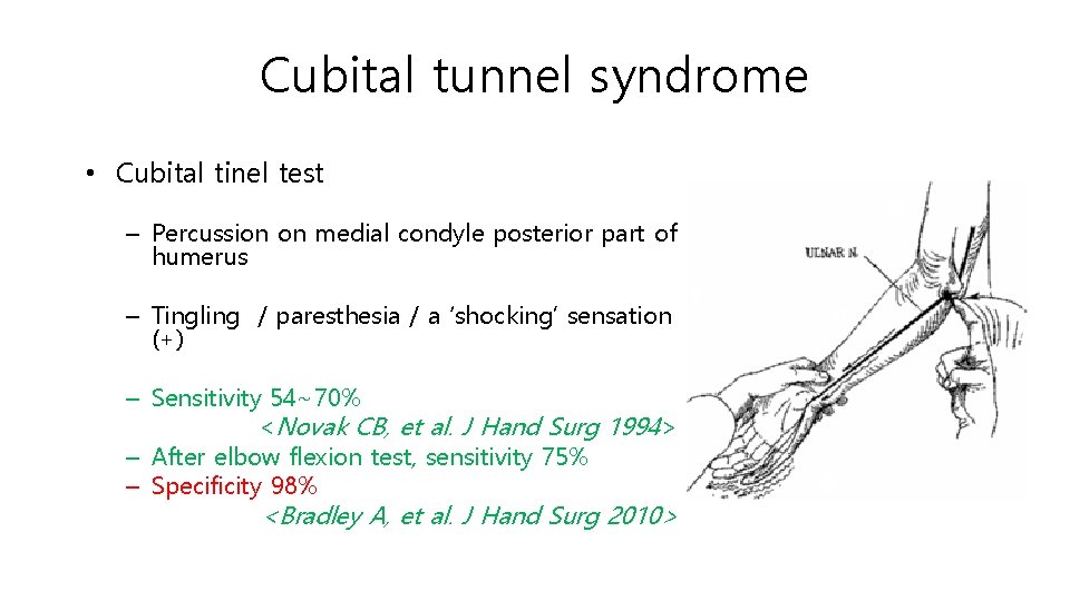 Cubital tunnel syndrome • Cubital tinel test – Percussion on medial condyle posterior part