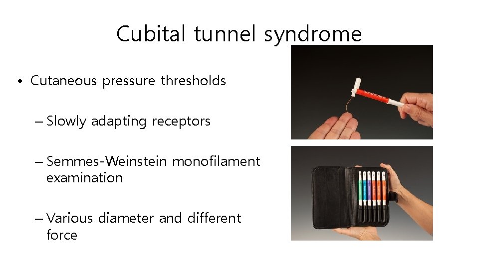 Cubital tunnel syndrome • Cutaneous pressure thresholds – Slowly adapting receptors – Semmes-Weinstein monofilament