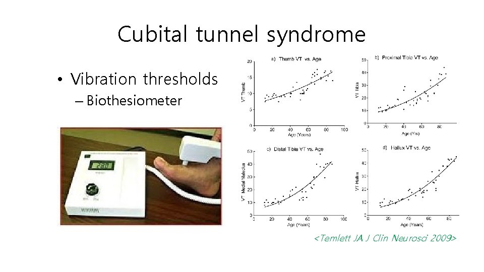 Cubital tunnel syndrome • Vibration thresholds – Biothesiometer <Temlett JA J Clin Neurosci 2009>