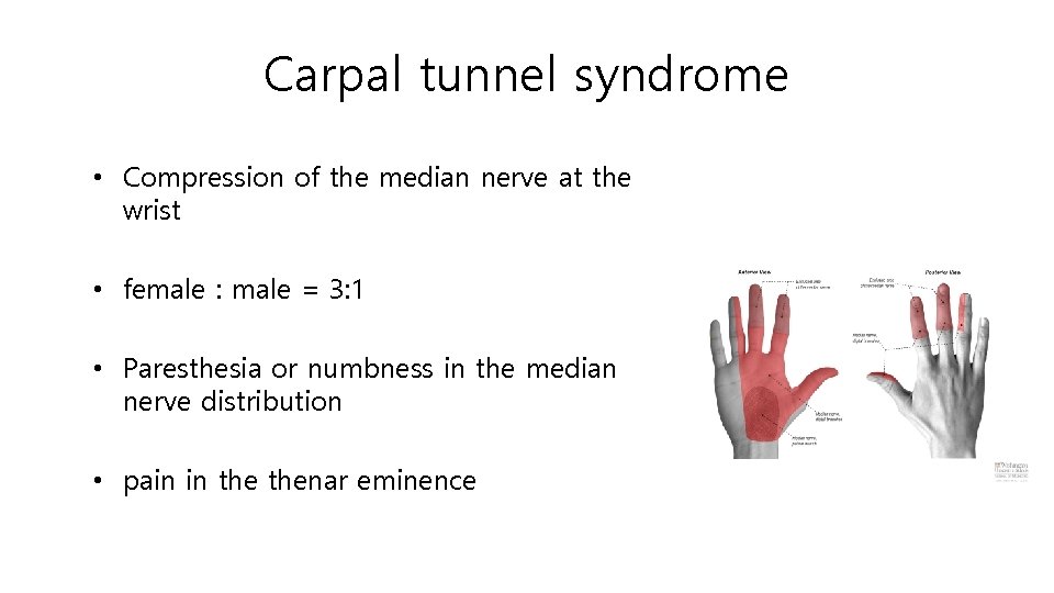 Carpal tunnel syndrome • Compression of the median nerve at the wrist • female