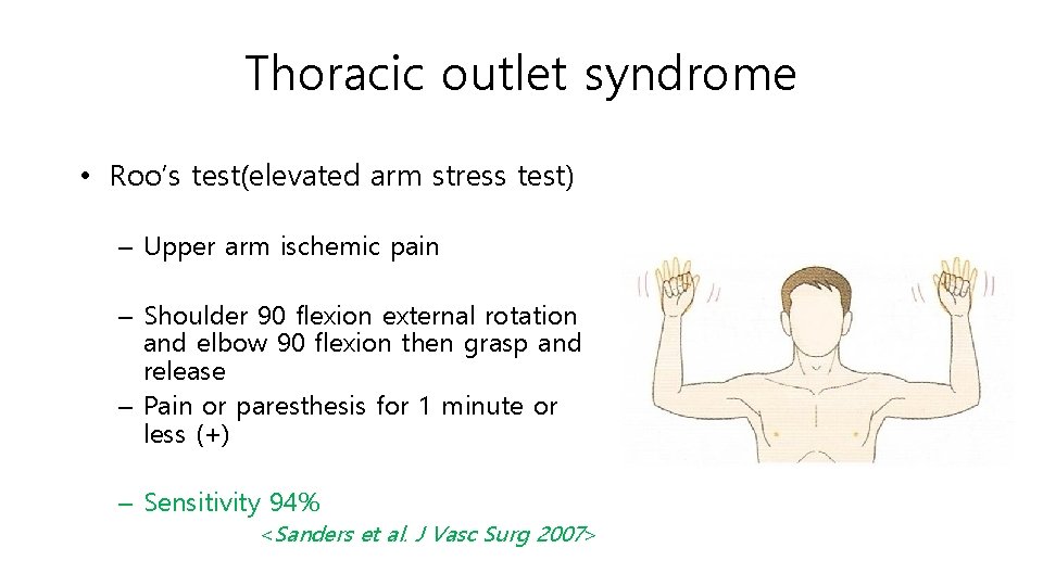 Thoracic outlet syndrome • Roo’s test(elevated arm stress test) – Upper arm ischemic pain