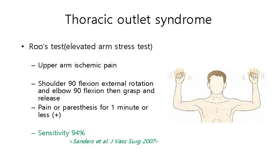 Thoracic outlet syndrome • Roo’s test(elevated arm stress test) – Upper arm ischemic pain