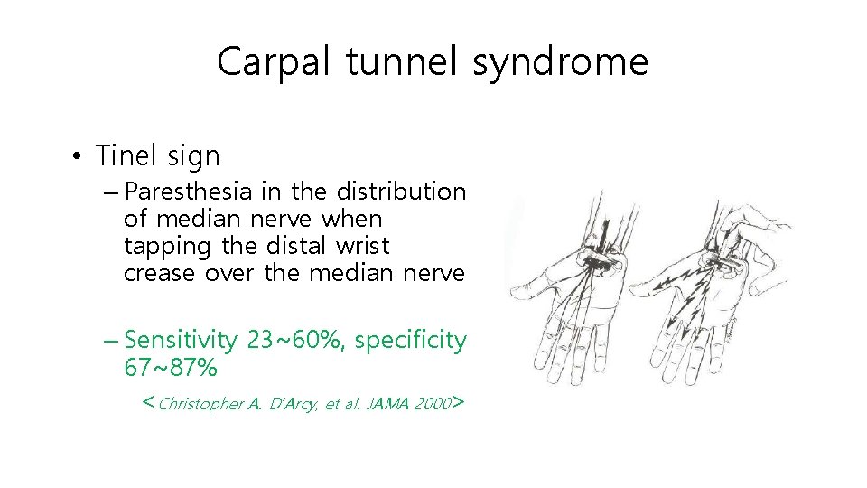 Carpal tunnel syndrome • Tinel sign – Paresthesia in the distribution of median nerve