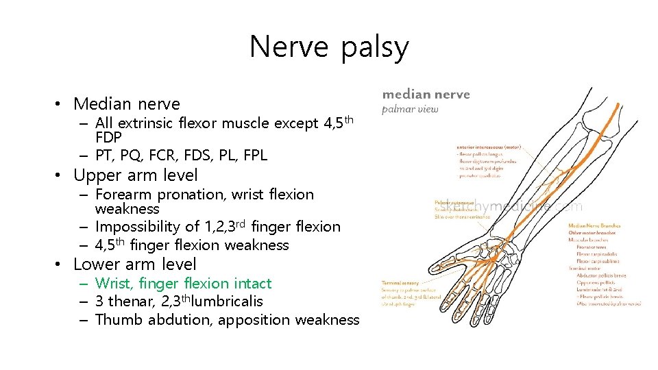 Nerve palsy • Median nerve – All extrinsic flexor muscle except 4, 5 th