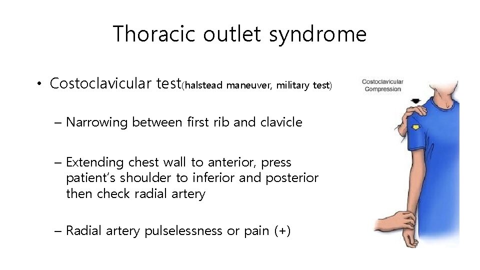 Thoracic outlet syndrome • Costoclavicular test(halstead maneuver, military test) – Narrowing between first rib