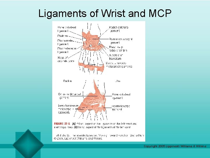 Ligaments of Wrist and MCP Copyright 2005 Lippincott Williams & Wilkins 
