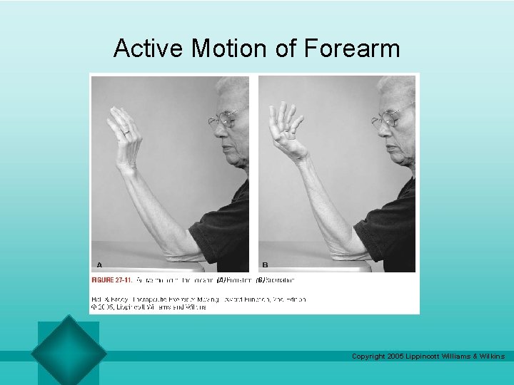 Active Motion of Forearm Copyright 2005 Lippincott Williams & Wilkins Active Motion of Forearm Copyright 2005 Lippincott Williams & Wilkins