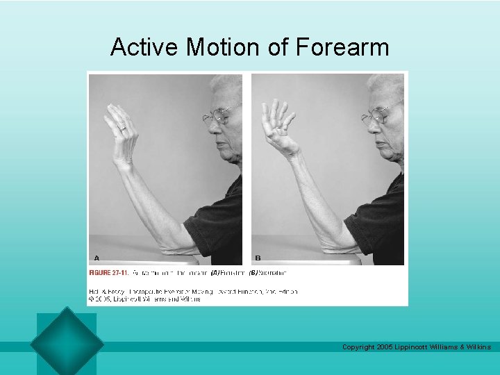 Active Motion of Forearm Copyright 2005 Lippincott Williams & Wilkins 