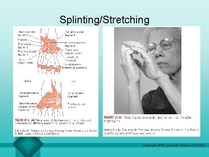Splinting/Stretching Copyright 2005 Lippincott Williams & Wilkins 