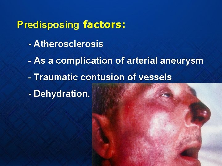 Predisposing factors: - Atherosclerosis - As a complication of arterial aneurysm - Traumatic contusion