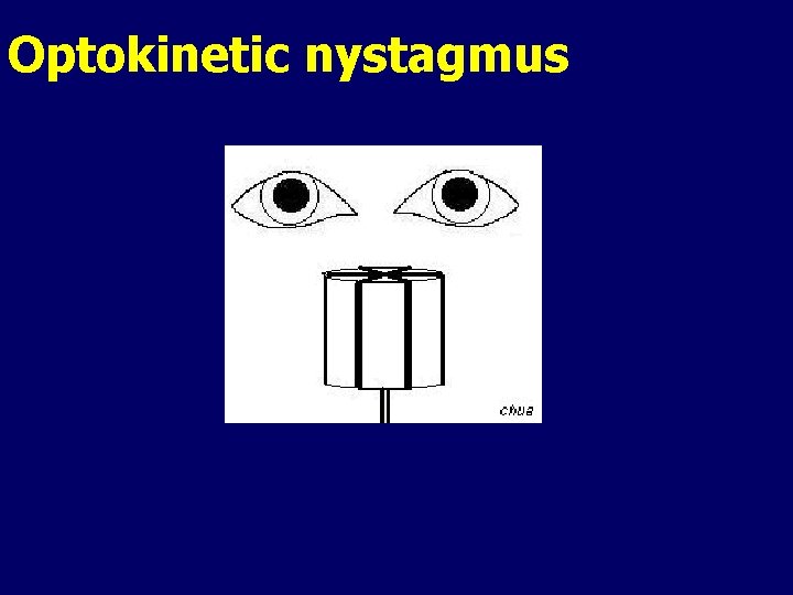 Optokinetic nystagmus Optokinetic nystagmus
