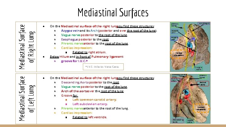 Mediastinal Surface of Right Lung of Left Lung Mediastinal Surfaces ● ● On the