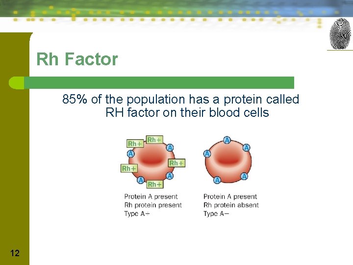 Rh Factor 85% of the population has a protein called RH factor on their