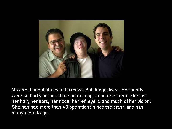 No one thought she could survive. But Jacqui lived. Her hands were so badly