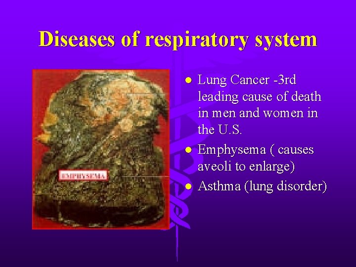 Diseases of respiratory system l l l Lung Cancer -3 rd leading cause of