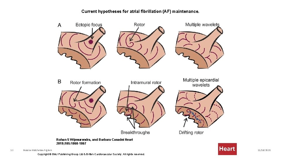 Current hypotheses for atrial fibrillation (AF) maintenance. Rohan S Wijesurendra, and Barbara Casadei Heart