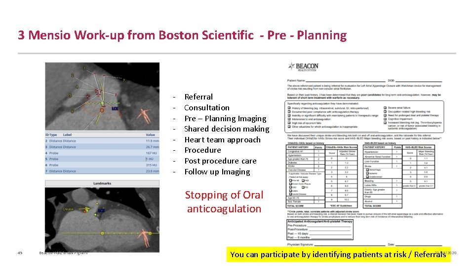3 Mensio Work-up from Boston Scientific - Pre - Planning - Referral Consultation Pre
