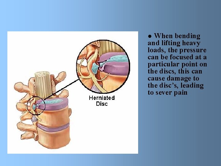 When bending and lifting heavy loads, the pressure can be focused at a particular