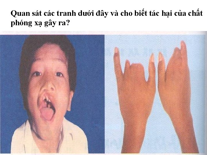 Quan sát các tranh dưới đây và cho biết tác hại của chất phóng