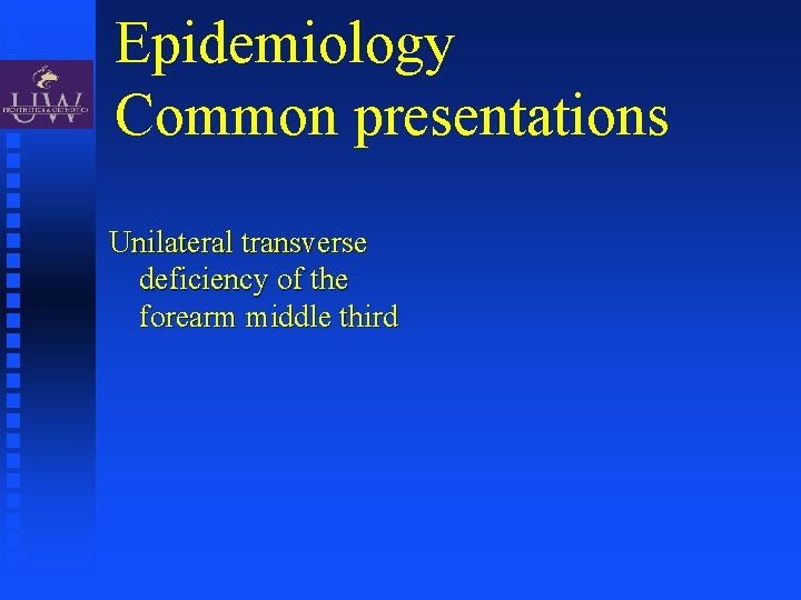 Epidemiology Common presentations Unilateral transverse deficiency of the forearm middle third 