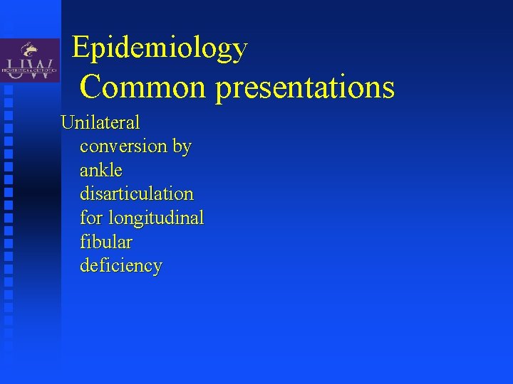 Epidemiology Common presentations Unilateral conversion by ankle disarticulation for longitudinal fibular deficiency 