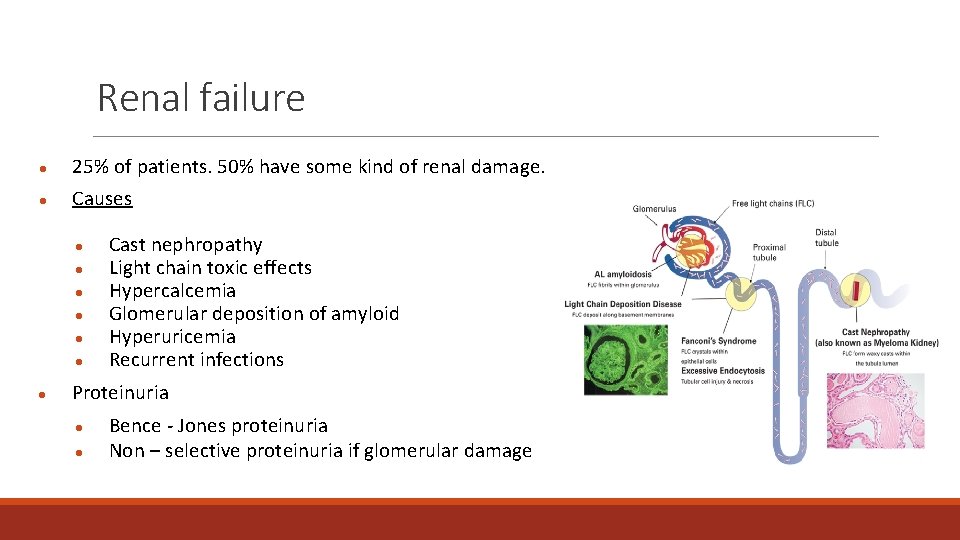 Renal failure ● ● 25% of patients. 50% have some kind of renal damage.